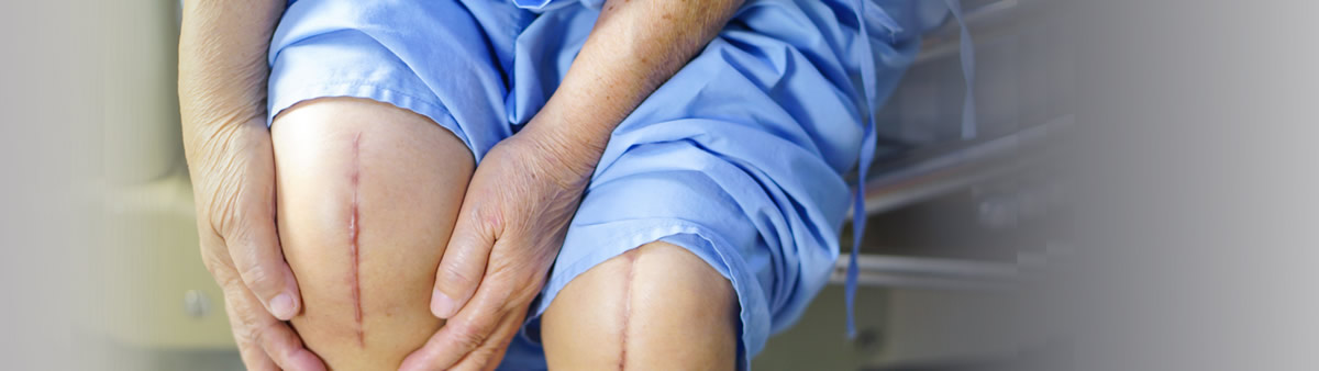 Total Knee Replacement